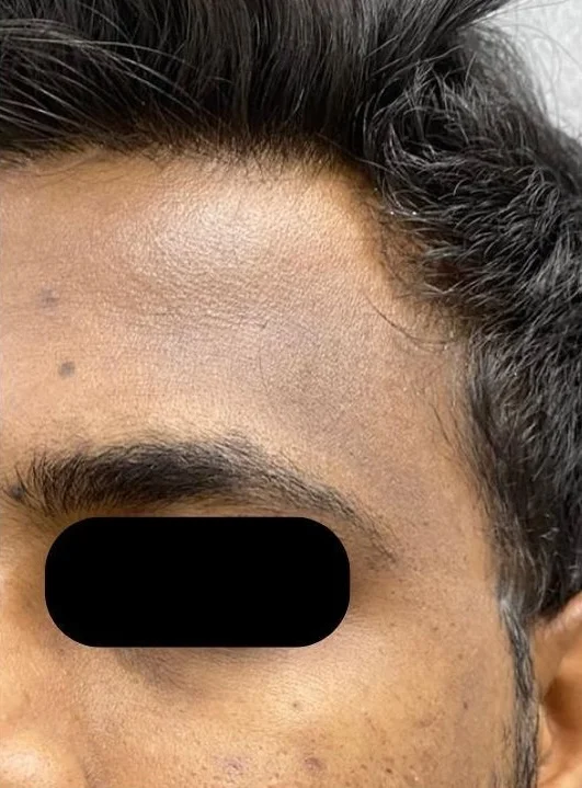 After treatment result 5