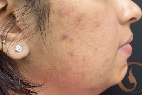 Before treatment 3