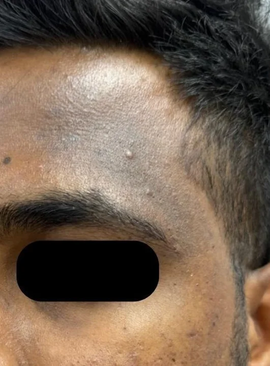 Before treatment 5