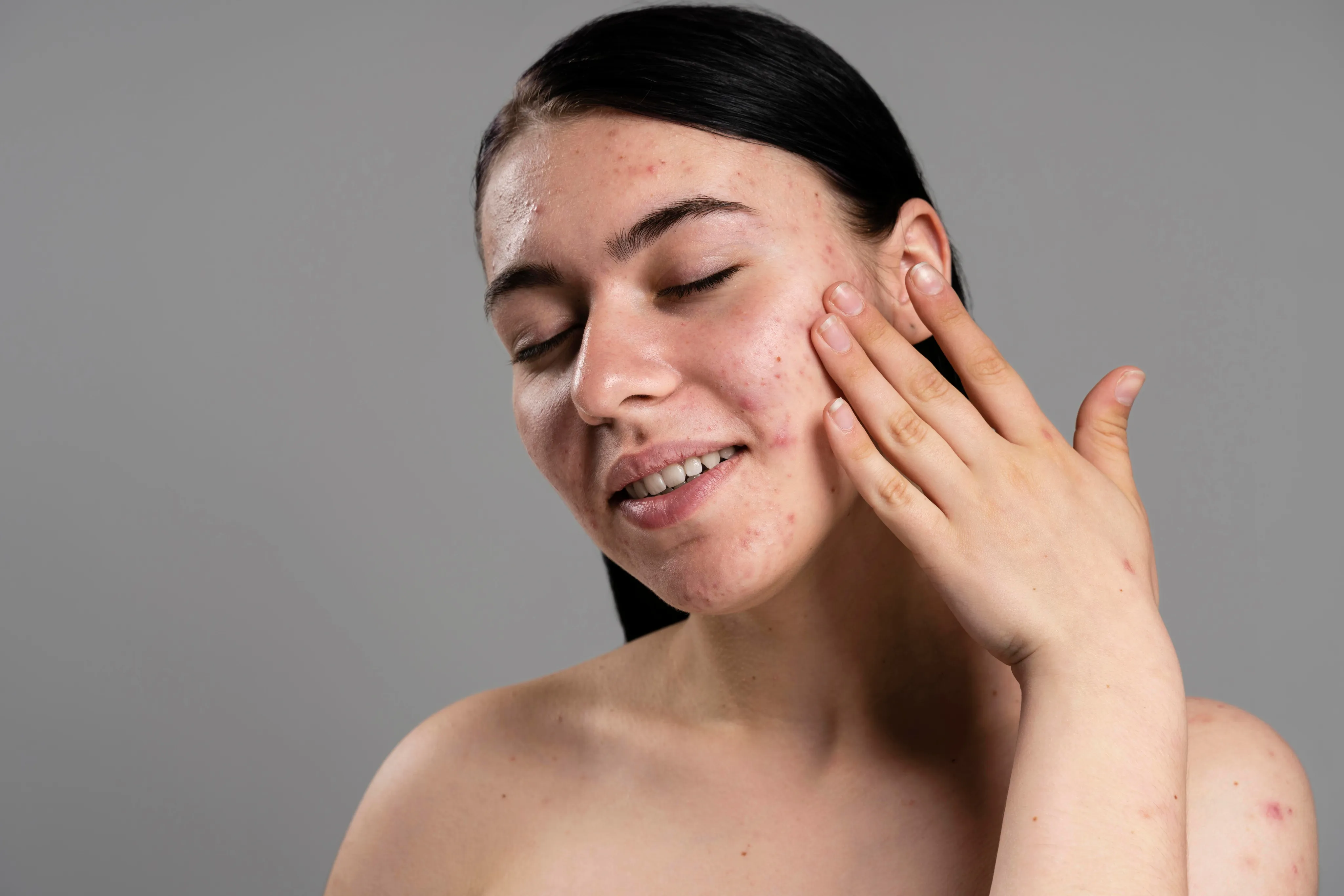 Medical Dermatology